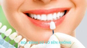 BỌC RĂNG SỨ CÓ BỀN KHÔNG