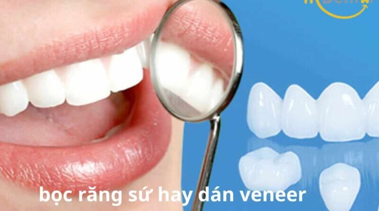 bọc răng sứ hay dán sứ veneer