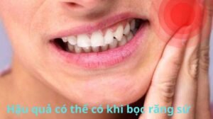 Hậu quả có thể có bọc răng sứ